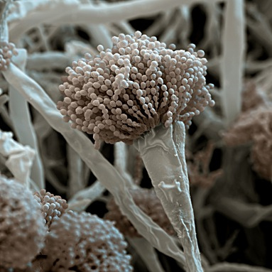 aspergillus-fumigatus-electron-micrograph-photo
